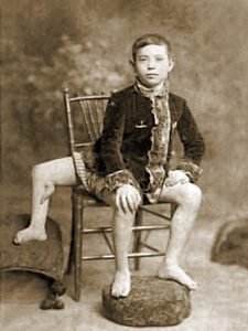 Frank Lentini 2
