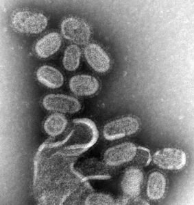 INFLUENZA
